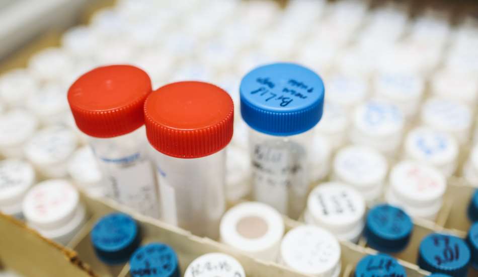 Blasenentzündung: Labordiagnostik als verlässlicher Helfer.